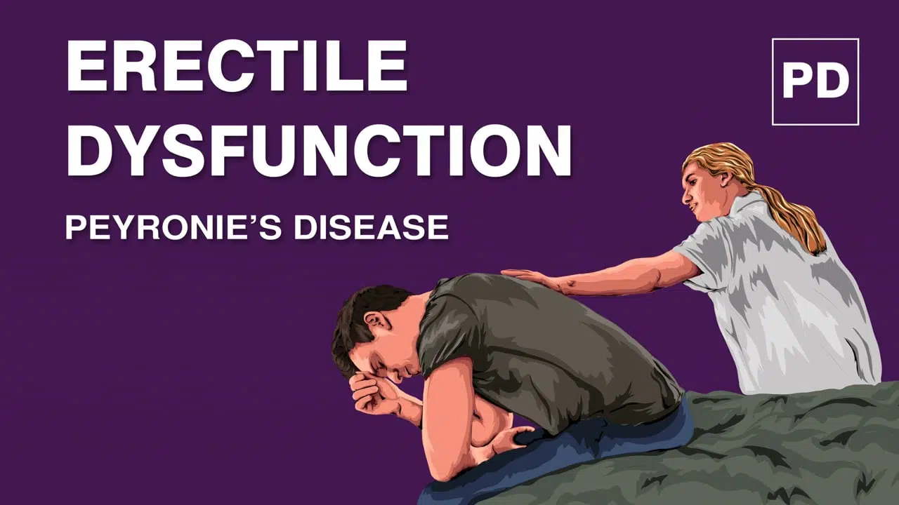 Erectile Dysfunction and Peyronie’s Disease