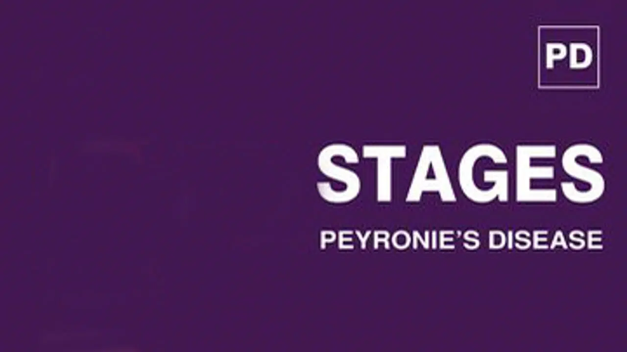 Peyronie’s Disease Stages