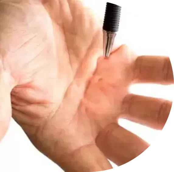 Peyronie's Disease & Dupuytren's Disease