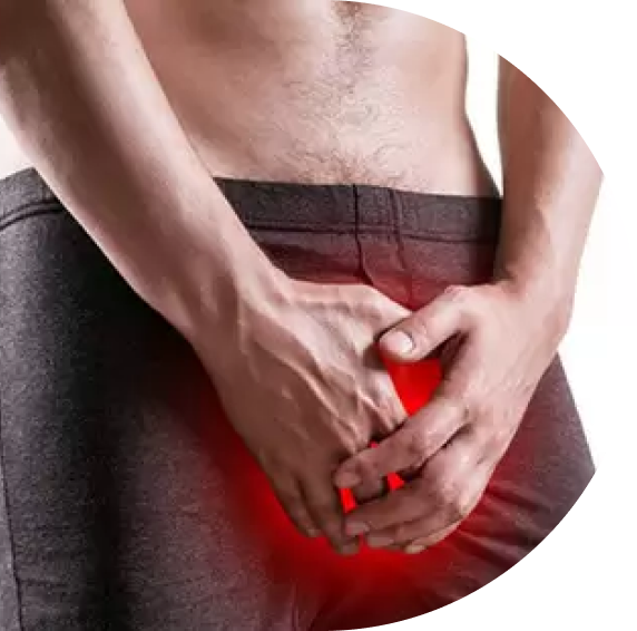 Peyronie's Disease After Injury