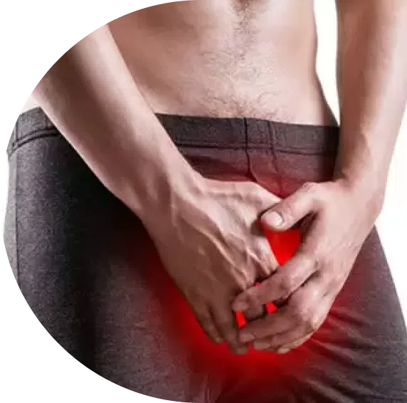 Peyronie's Disease & Prostate Cancer