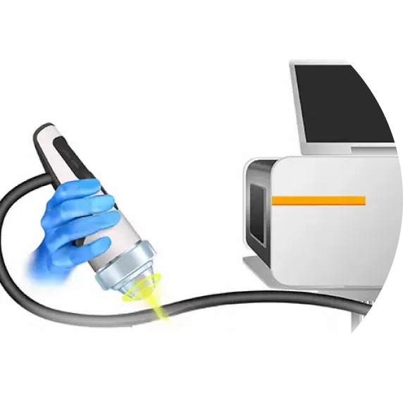 Focused Shockwave Therapy
