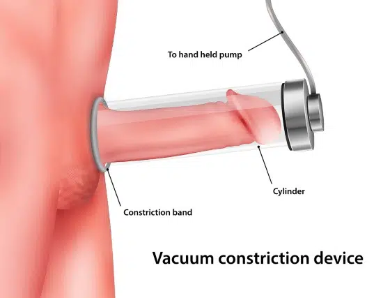 Vacuum pump