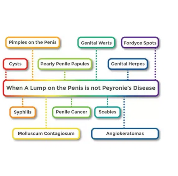 When A Lump on the Penis is not Peyronie's Disease