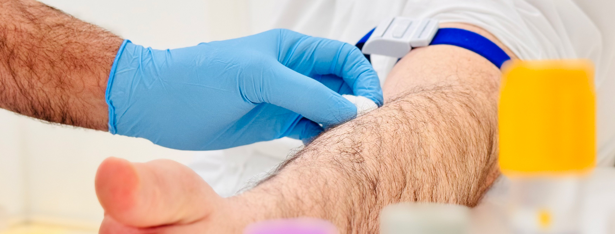 Peyronie’s Disease & Rare Condition